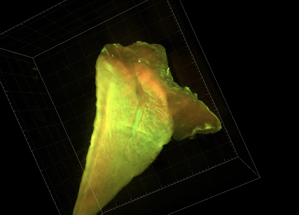 3D image of knee meniscus