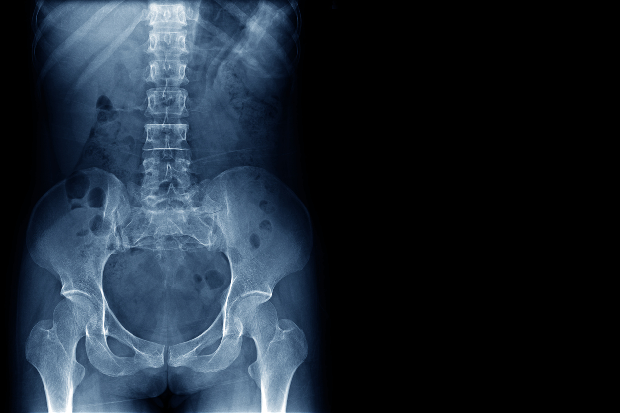 x-ray of human spine and pelvis