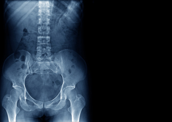 x-ray of human spine and pelvis