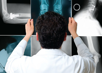 Dr. Adam Yanke Holding Up X-Ray Image