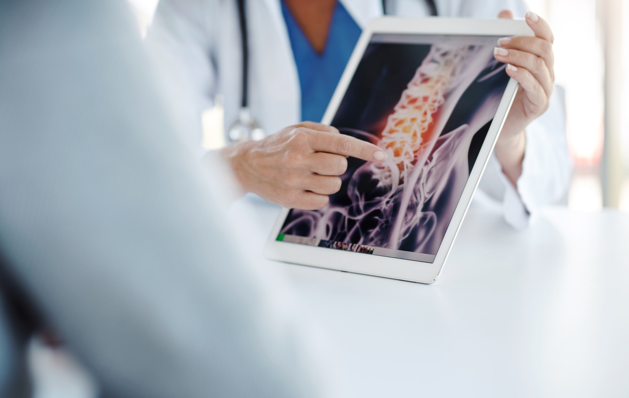 physician showing x-rays of spine